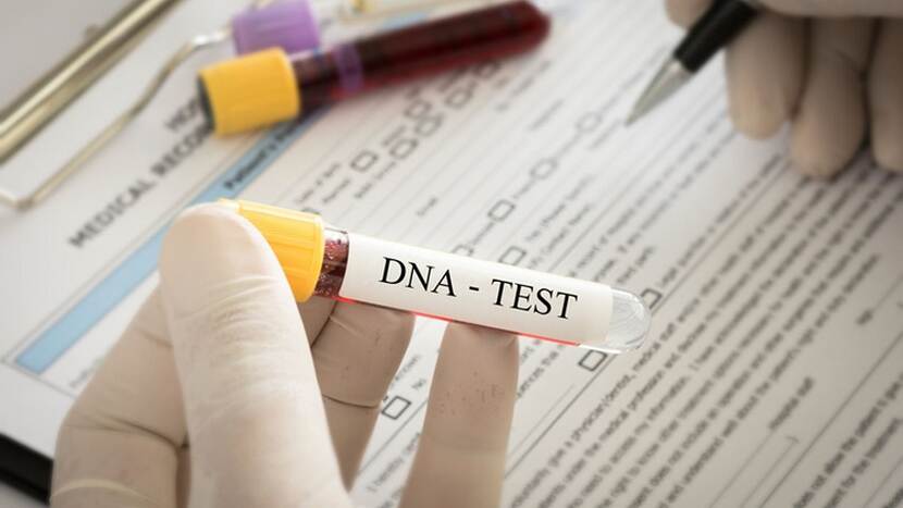 dna test in cameroon